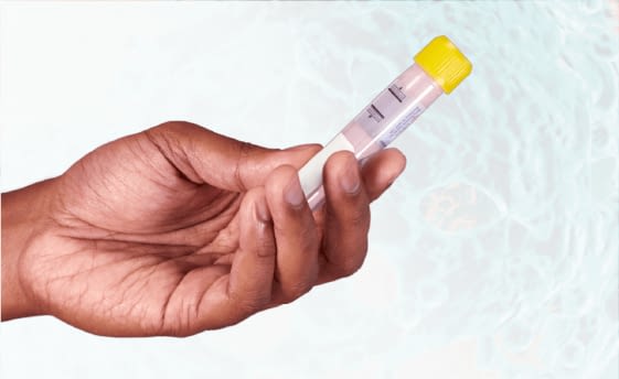 Prueba de Vírus de Papiloma Humano<br><br>